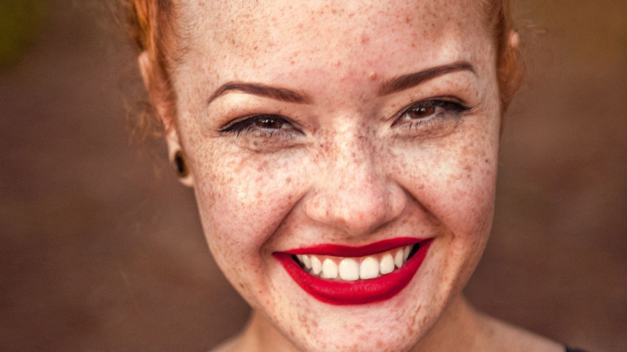 girl freckles unsplash